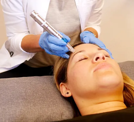 Acupuncture Healing Arts, Inc. - Microneedling